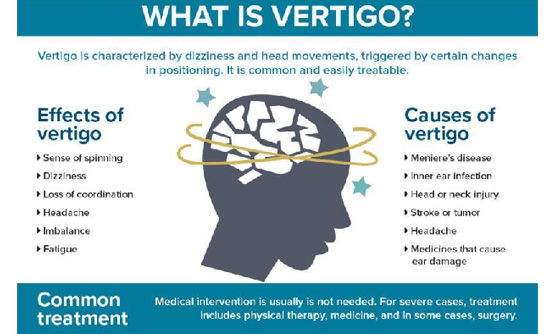 What is vertigo?